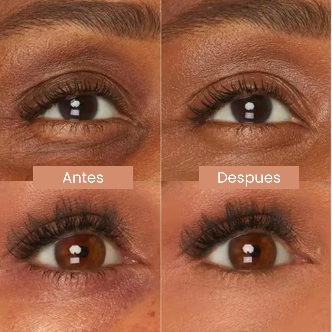 Ojeraless™ - Adiós ojeras, hola mirada fresca