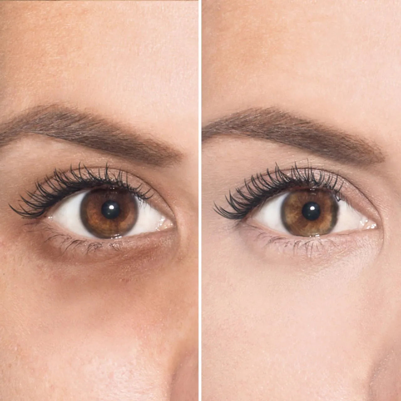 Ojeraless™ - Adiós ojeras, hola mirada fresca
